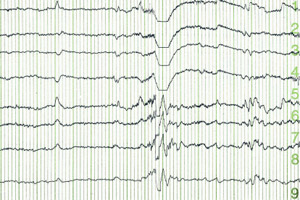 diagnostic_testing